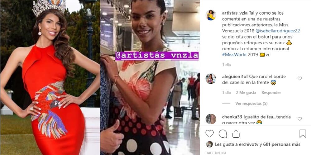 así-quedó-la-nariz-isabella-rodrguez-bisturis-publicacion-miss-venezuela-2018-movidatuy.com