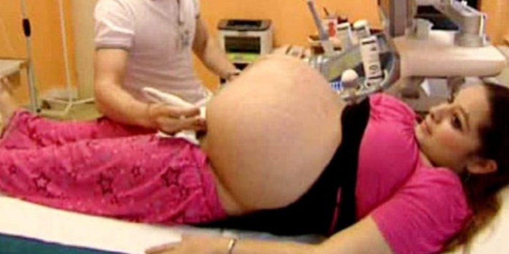 parto-insólito-40-medicos-atendieron-a-una-mujer-embarazada-movidatuy.com