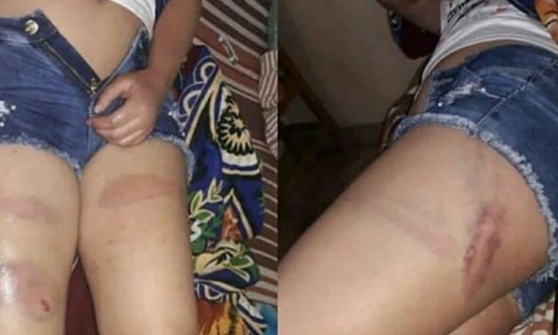 😲 Misoginia Xenófoba: venezolana fue golpeada por policías de Perú 😲