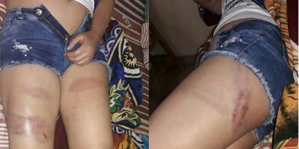 😲 Misoginia Xenófoba: venezolana fue golpeada por policías de Perú 😲