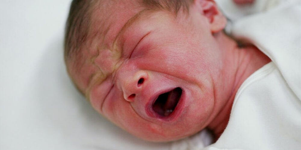 😮 Dentición prematura: En México nace una bebé con dos dientitos 😮