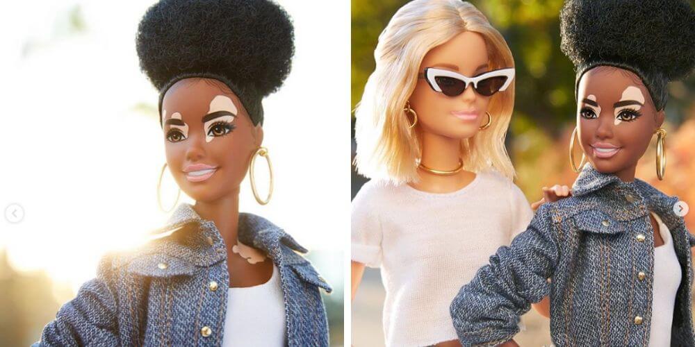 nueva-colección-de-barbie-incluye-a-una-muñeca-con-vitiligo-barbie-afroamericana-vitiligo-movidatuy.com