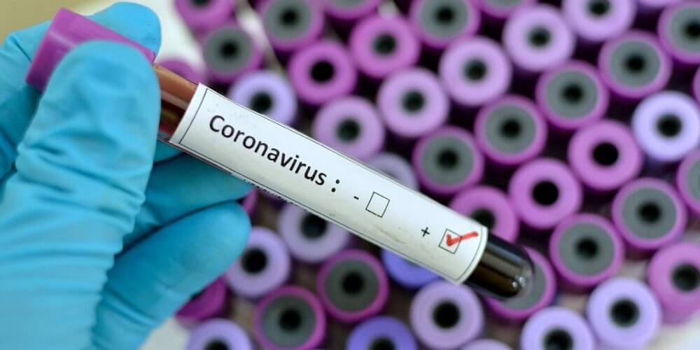 Coronavirus-es-oficial-su-llegada-a-América-Latina-Coronavirus-América-Latina-movidatuy.com