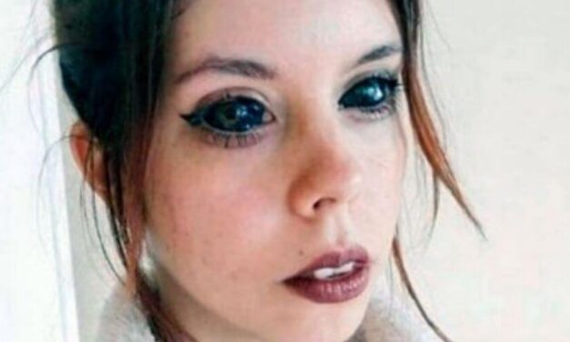 😮 Increíble: Quedó ciega luego de haberse tatuado los ojos 😮