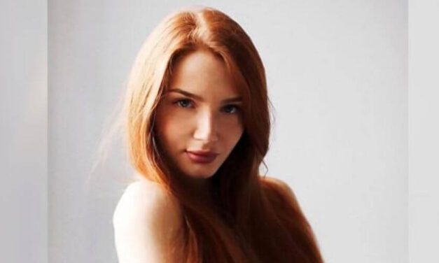 ✌ Sufría de alopecia y hoy la llaman la “Rapunzel de carne y hueso” ✌