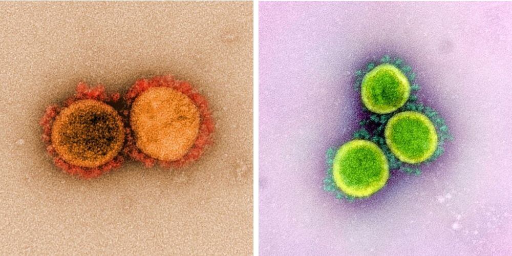 primeras-imágenes-tomadas-al-coronavirus-bajo-el-microscopio-divicion-virus-movidatuy.com