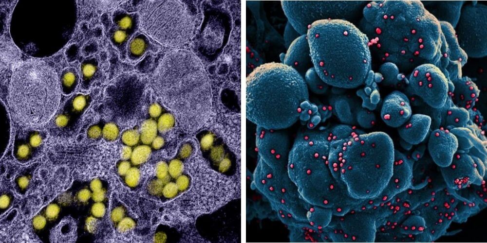 primeras-imágenes-tomadas-al-coronavirus-bajo-el-microscopio-virus-bajo-distintos-ambientes-movidatuy.com