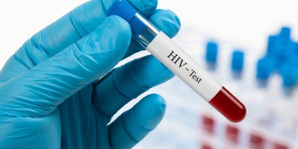 segundo-paciente-con-VIH-se-curo-es-un-gran-avance-para-la-ciencia-test-sangre-movidatuy.com