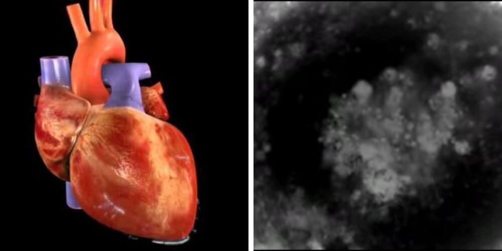 ✌ Científicos crean los primeros mini-corazones humanos a partir células madre ✌