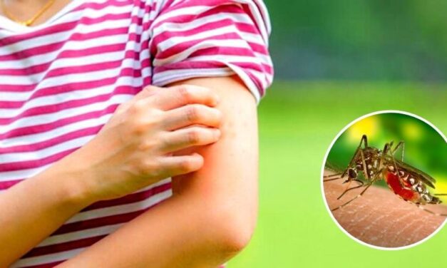 ✅ Consejos para eliminar rápidamente las picaduras de mosquitos del cuerpo ✅