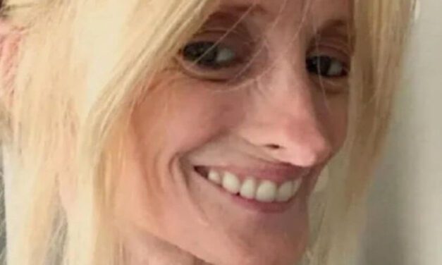 😮 Esta mujer envejece 8 veces más rápido de lo normal debido a una enfermedad 😮