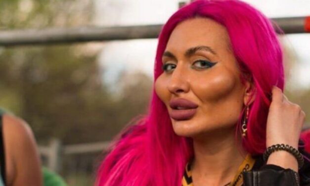 😮 Esta es la mujer de las mejillas de bótox y asegura ser muy feliz así 😮