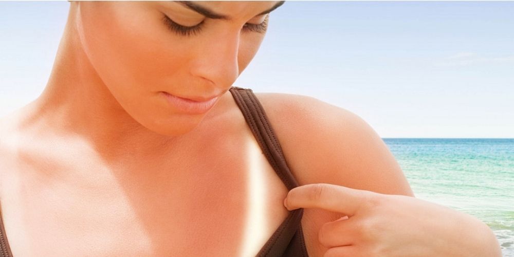 ✅ Cómo aclarar la piel quemada por el sol con remedios caseros ✅