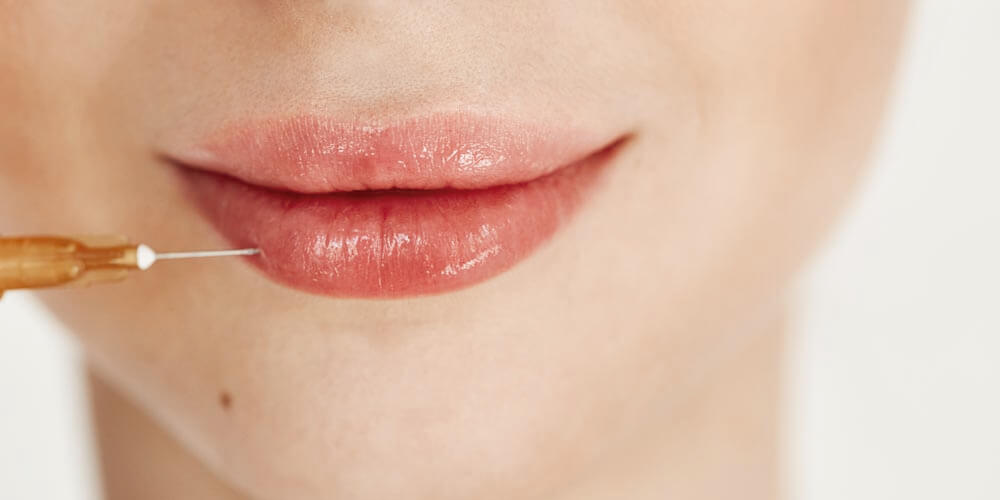 uso del ácido h en los labios - movidatuy