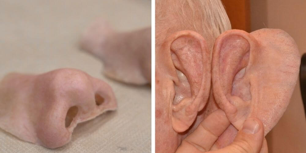 medico-ayuda-con-protesis-3D-realistas-a-pacientes-que-han-perdido-partes-del-rostro-partes-nariz-oreja-movidatuy.com