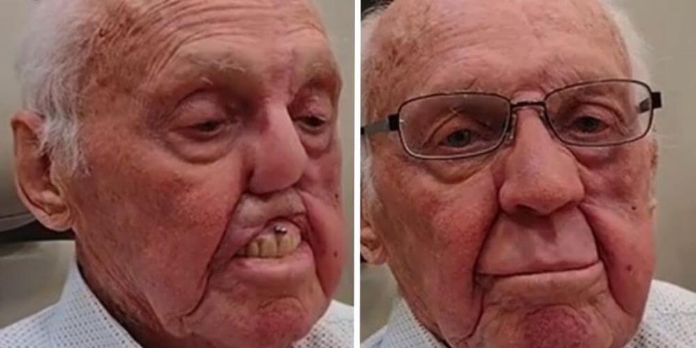 ✌️ Médico ayuda con prótesis 3D realistas a pacientes que han perdido partes del rostro ✌️